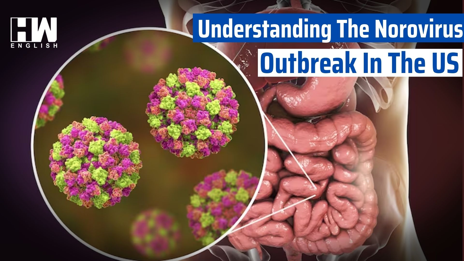 Understanding The Norovirus Outbreak In The US HW News English